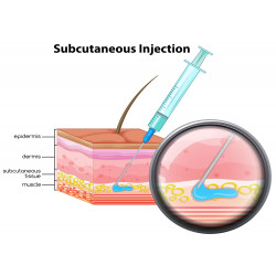 Subcutaneous Injection (OSCE) 